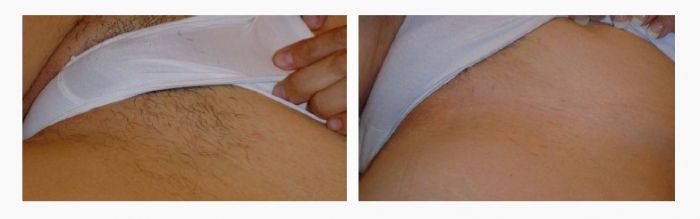 ȻᲿλëǰ ȻҪ¶˿ ݲλѡëƷ