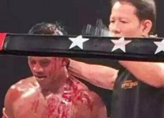 ̩ȭͷ ̩ȭ󱻱ͷԺ רң𾪣